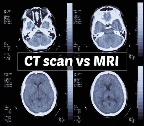 tests for soft tissue ligaments muscles|CT Scan Versus MRI Versus X.